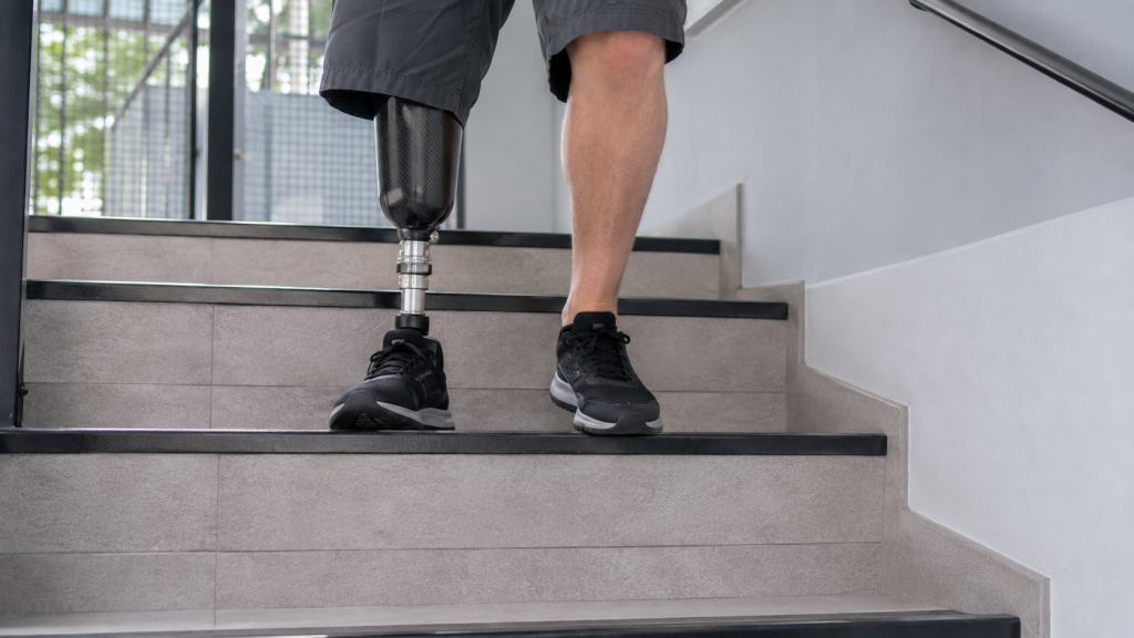 Лестница на протезе